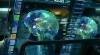 Cliquez pour zoomer : Cerveau